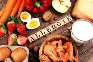 Allergie e intolleranze alimentari: quali sono, i sintomi e i test da fare